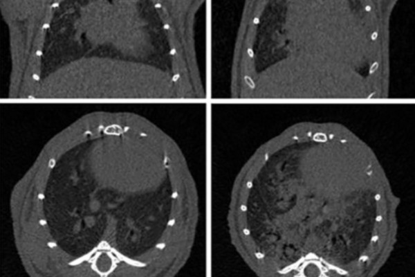 Longitudinal micro-CT provides biomarkers of lung disease that can be used to assess the effect of therapy in preclinical mouse models, and reveal compensatory changes in lung volume